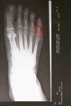 20061003111710-radiografia-laura-2b-2.jpg